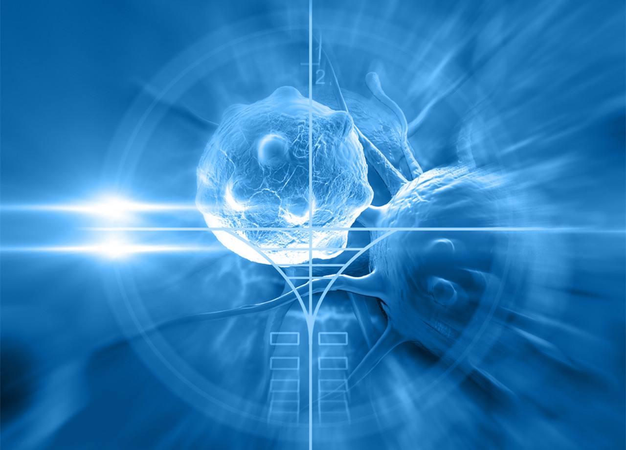 癌癥應(yīng)作慢性病看治療，切莫走極端